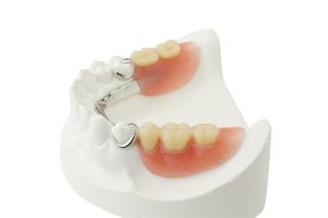 partial dentures