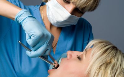 Tooth Extraction